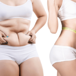 Simple Ways to Lose Weight Naturally Without Exercises